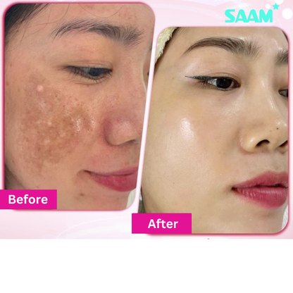 Crème  Anti-Taches Mélasma & Tâches hyperpigmentaires & Éclaircissante