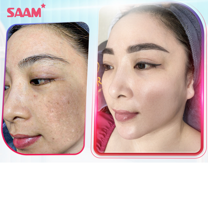 Crème  Anti-Taches Mélasma & Tâches hyperpigmentaires & Éclaircissante